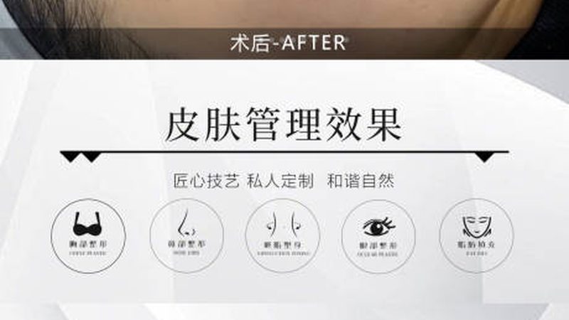 超声炮探头材质，选错了等于白做
