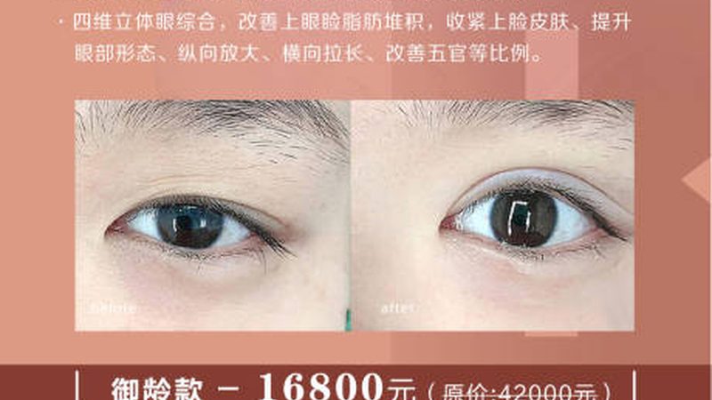 北京埋线提升术后恢复：揭秘时间与注意事项