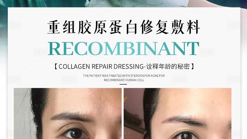 脸部注射物取出修复：揭秘安全有效的修复流程**