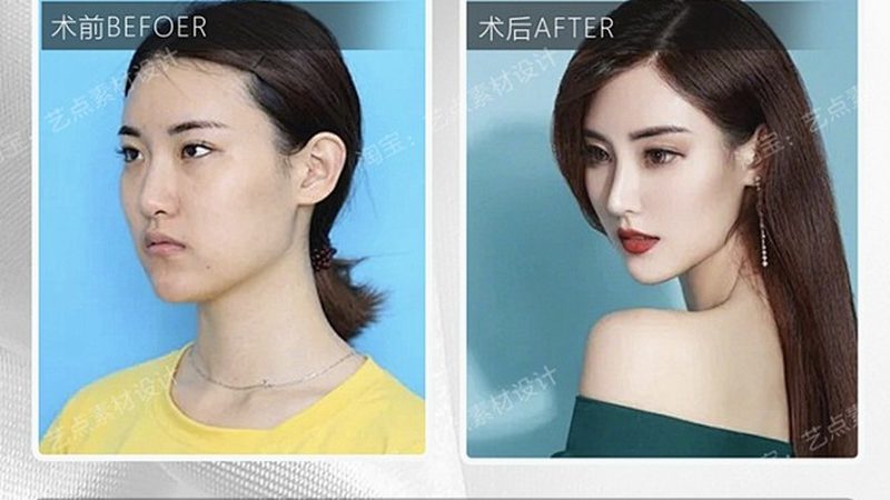 医疗美容咨询师：揭秘工作内容与规范