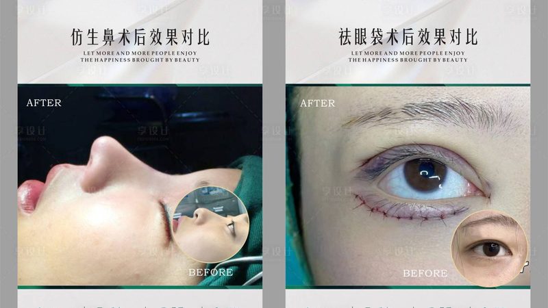 激光祛斑疗程，揭秘有效次数的真相