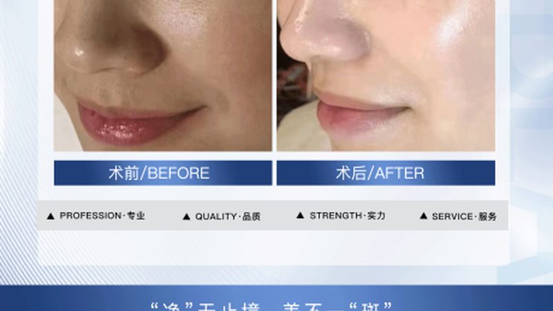 微整形和手术整形哪个性价比高