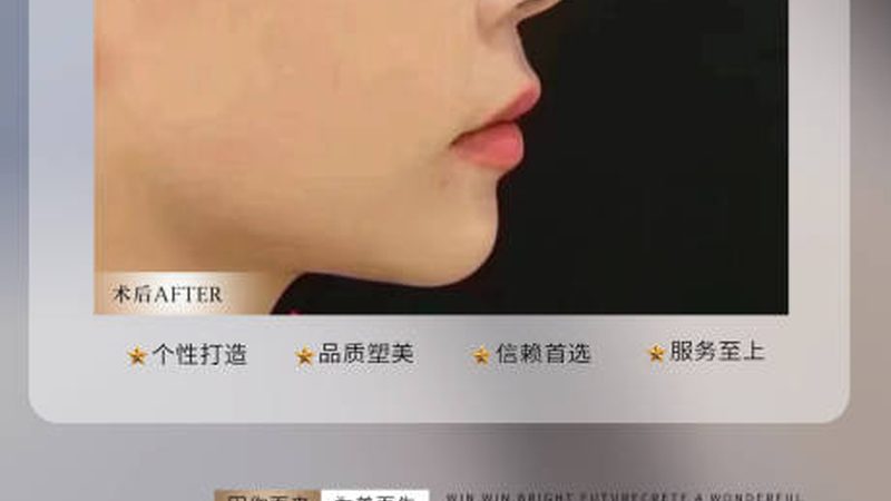 医美局麻的优缺点