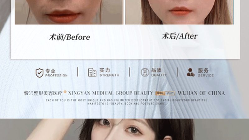 上海皮肤管理门店运营流程揭秘：从服务到管理的全方位解析