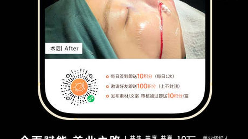 广州双眼皮手术，如何选择适合自己的价格？**