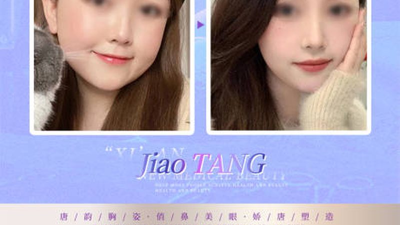 视黄醇抗衰护肤品：揭秘其护肤原理与挑选技巧