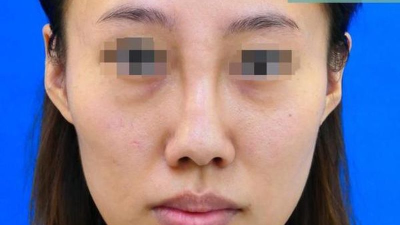 医用美容仪器参数对比，揭秘选购背后的秘密**
